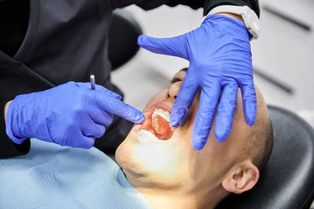 Best Emergency Tooth Extraction in Marshfield, MO